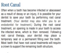 Root Canal Information, Common Dental Procedures, Replacing a Lost Tooth, Brampton Dentists, To Dentists in Brampton, Dental Facts, Dental Information,
